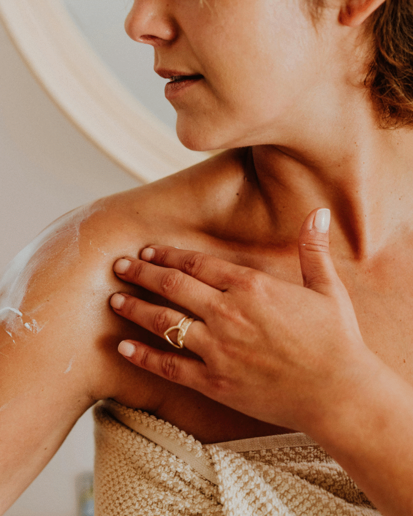 Applying moisturizer for dry, itchy psoriasis skin